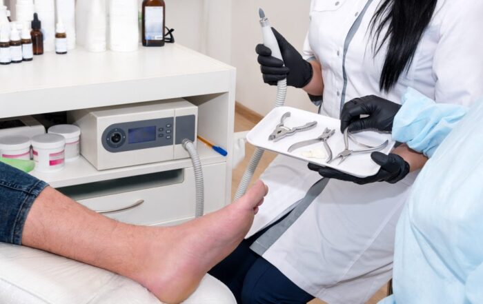 Preventing Ingrown Toenails: Tips for Proper Nail Care