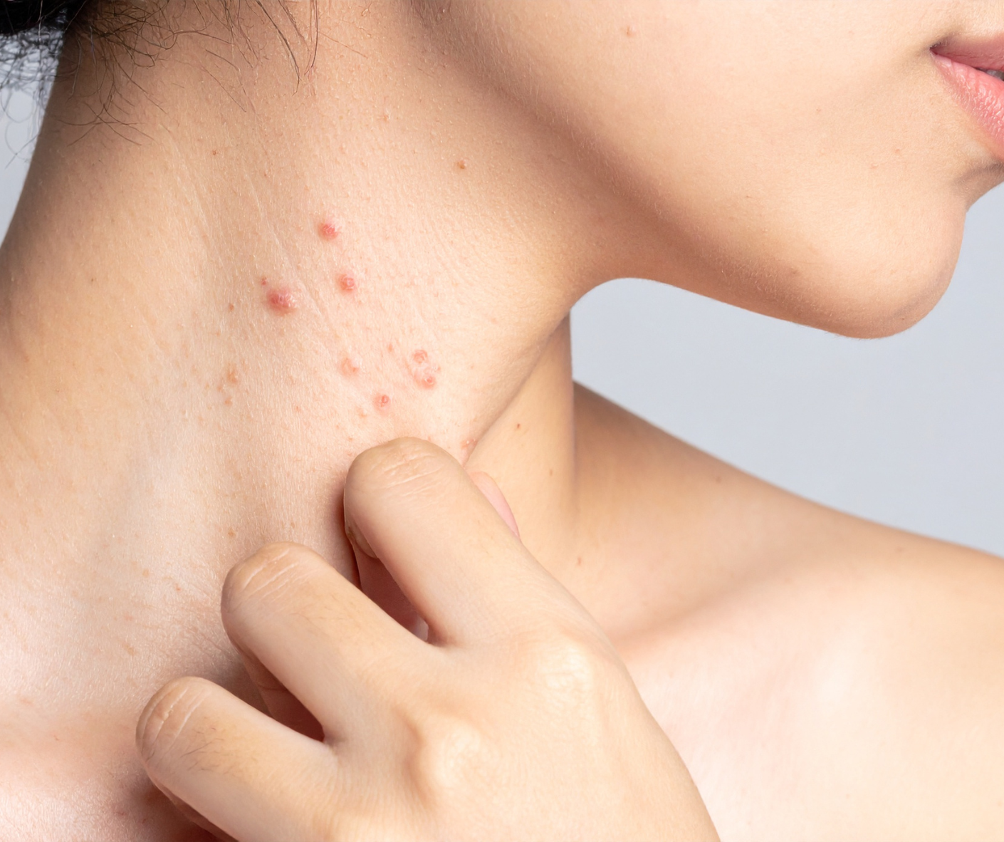 Understanding Chronic Skin Allergy Conditions